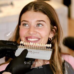 A woman smiles as her teeth are cleaned, highlighting her porcelain veneers in Scottsdale, AZ 