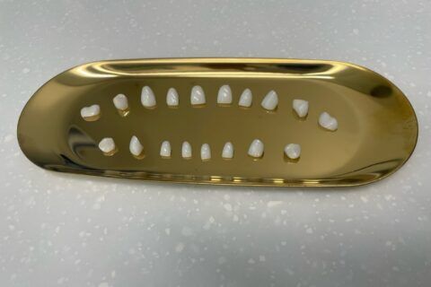 A close-up of a dental veneer kept on a plate in Scottsdale, AZ.