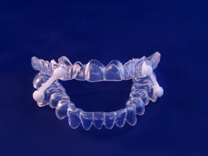 Appliance for obstructive sleep apnea from our dental office in Scottsdale AZ