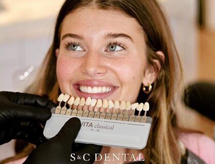 A woman smiles as her teeth are cleaned, highlighting her porcelain veneers in Scottsdale, AZ